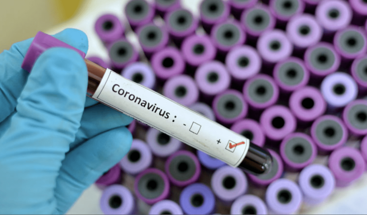 Researchers at the University of Queensland in Australia are rushing to develop a vaccine for the Wuhan coronavirus