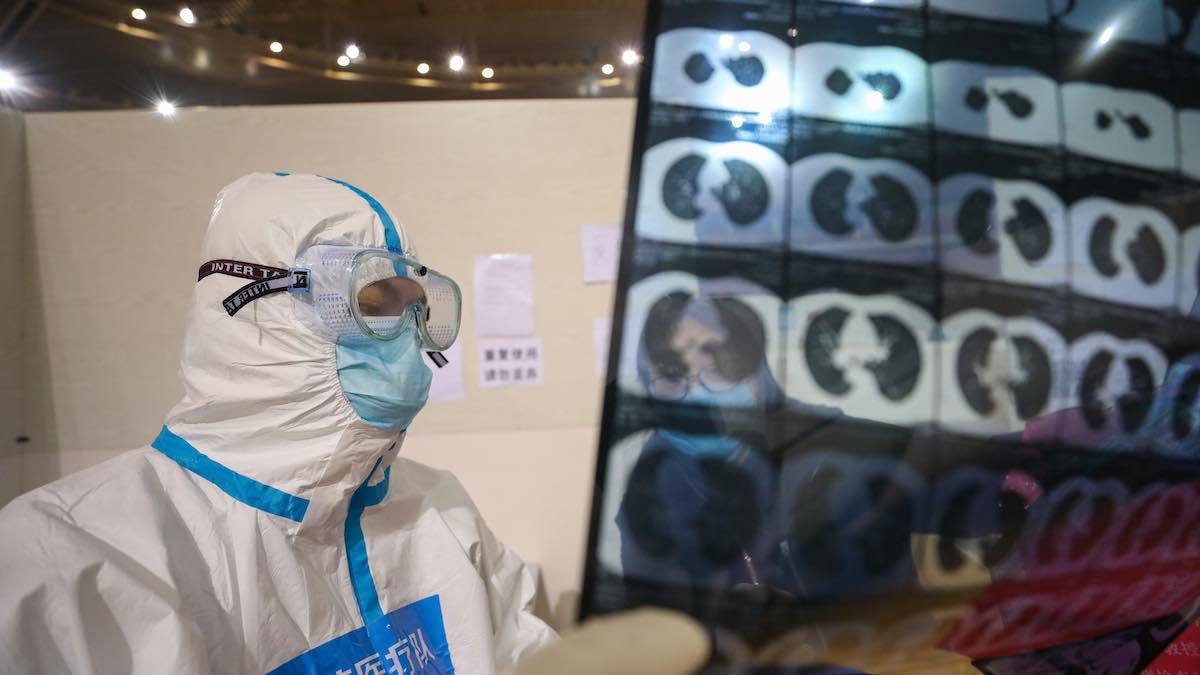 A doctor checks a patient’s CT scan at a temporary hospital set up for Covid-19-infected patients in Wuhan, China.